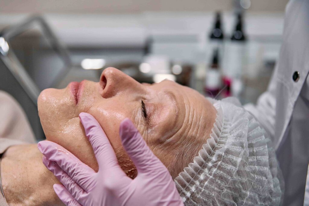 Microneedling and Botox